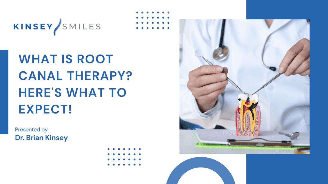What is Root Canal Therapy Here's What to Expect!