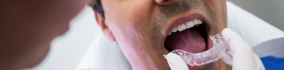 invisalign kinsey smiles dacula